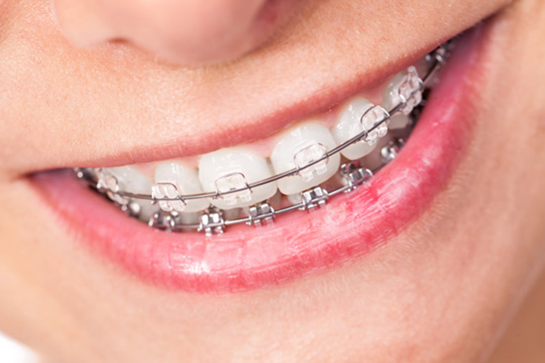 Orthodontics Dental Service Image