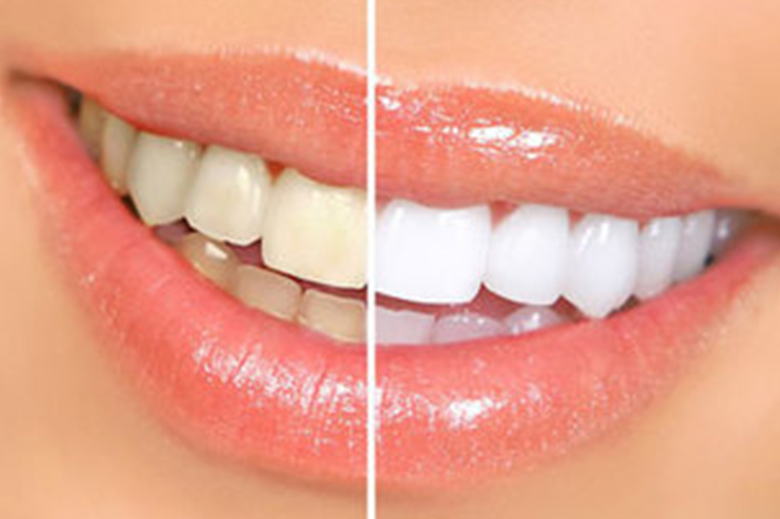 Cosmetic Dentistry Image